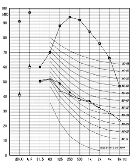 図6 暗騒音グラフ